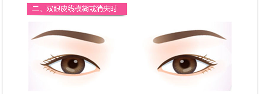 ˫Ƥ,˫Ƥ ,˫Ƥ޸ 