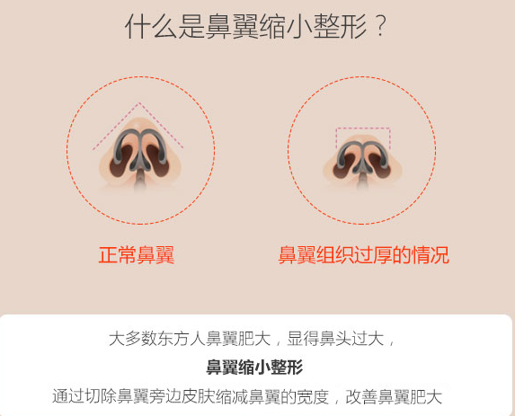 ϺСǮ