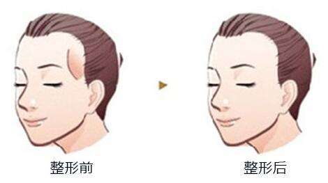 ̫Ѩ